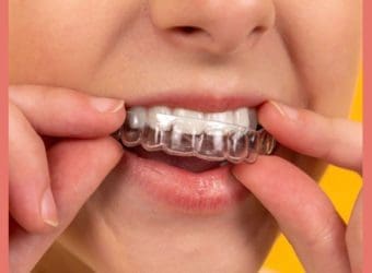 How to Talk to Your Kids About Getting Braces